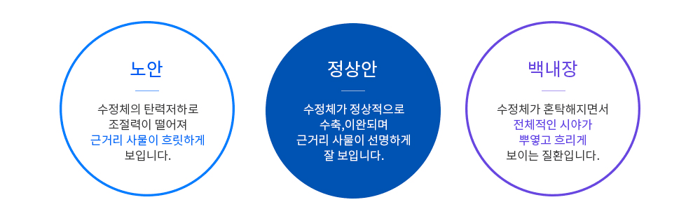 노안과 백내장의 차이점 - 하늘안과